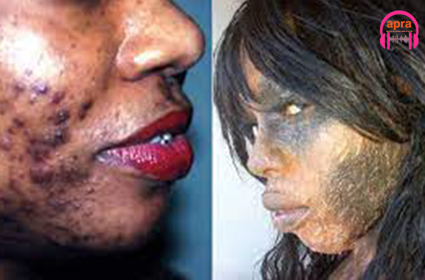 Beauté : Dans l’univers des produits décapants